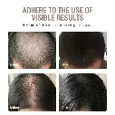 regrowth3.webp